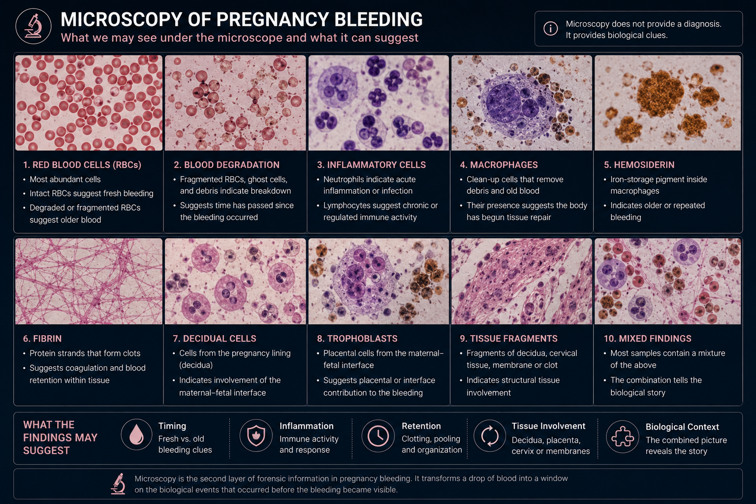 Microscope image concept showing pregnancy bleeding analyzed through magnified views of blood cells, inflammation, fibrin and tissue fragments.
