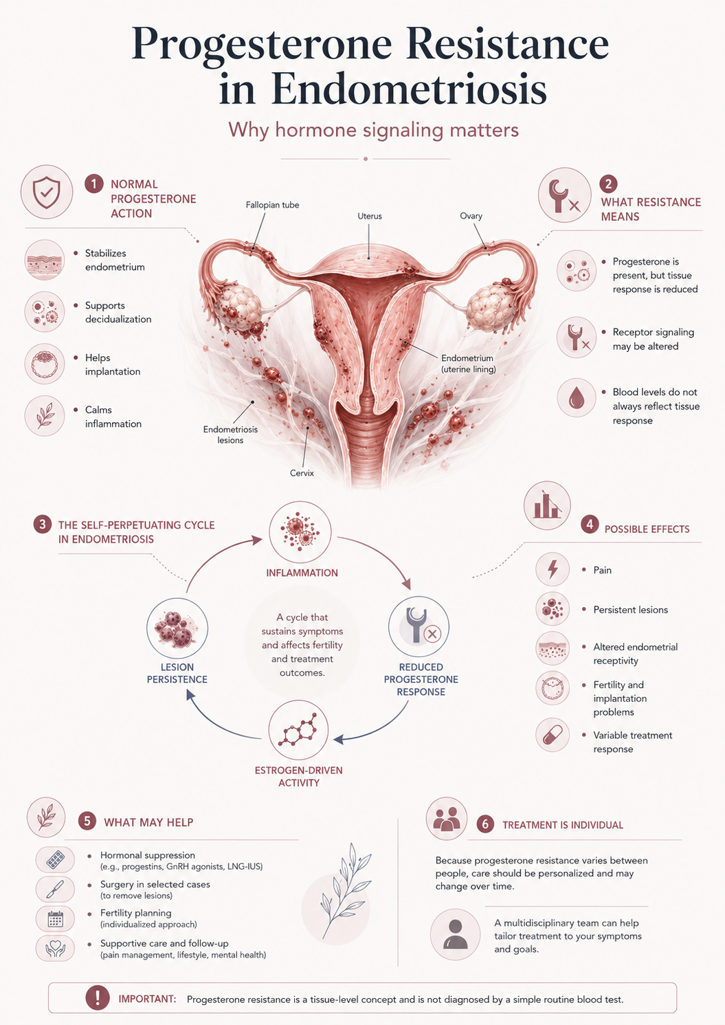 Progesterone Resistance in Endometriosis Infograph